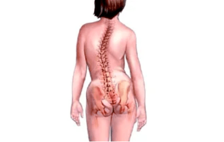 Las razones para el desarrollo de la osteocondrosis cervical