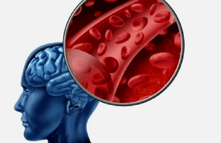 Síntomas de la osteocondrosis de la columna cervical