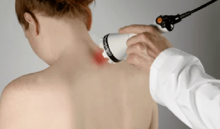 Tratamiento de la osteocondrosis cervical por fisioterapia