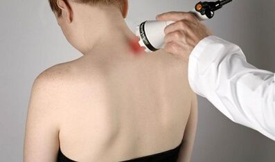 Tratamiento del dolor en el cuello Procedimientos fisioterapéuticos